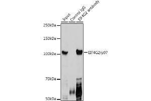 Immunoprecipitation analysis of 300 μg extracts of HeLa cells using 3 μg EIF4G2/p97 antibody (ABIN3016940, ABIN3016941, ABIN3016942 and ABIN6219894). (EIF4G2 anticorps  (AA 750-850))