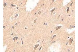 Immunohistochemical staining of formalin-fixed paraffin-embedded human brain tissue with ADAMTS4 polyclonal antibody  at 1 : 200 dilution. (ADAMTS4 anticorps  (C-Term))