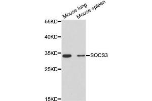 Western blot analysis of extracts of various cell lines, using SOCS3 antibody (ABIN2650956) at 1:3000 dilution. (SOCS3 anticorps)