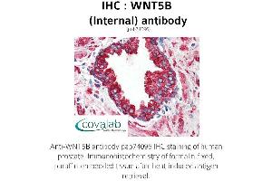 Image no. 2 for anti-Wingless-Type MMTV Integration Site Family, Member 5B (WNT5B) (Internal Region) antibody (ABIN1740832) (WNT5B anticorps  (Internal Region))