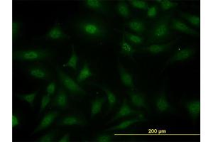 Immunofluorescence of monoclonal antibody to SUGT1 on HeLa cell.