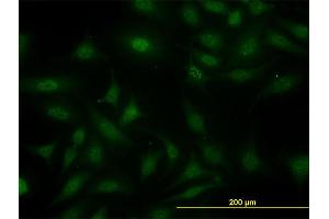 Immunofluorescence of monoclonal antibody to SUGT1 on HeLa cell. (SUGT1 anticorps  (AA 151-260))