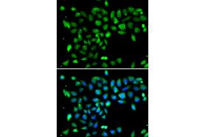 Immunofluorescence analysis of U2OS cells using DYRK2 antibody (ABIN5974219). (DYRK2 anticorps)