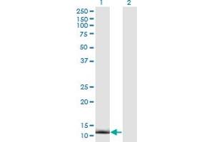 Western Blot analysis of CRABP2 expression in transfected 293T cell line by CRABP2 monoclonal antibody (M01), clone 4F2.