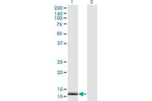 Western Blot analysis of CRABP2 expression in transfected 293T cell line by CRABP2 monoclonal antibody (M01), clone 4F2. (CRABP2 anticorps  (AA 1-138))