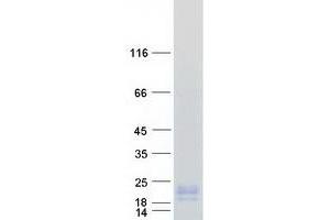 Validation with Western Blot