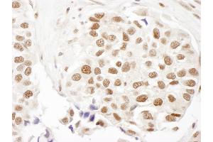 Immunohistochemistry (IHC) image for anti-Fanconi Anemia, Complementation Group D2 (FANCD2) (AA 1401-1451) antibody (ABIN7448562)