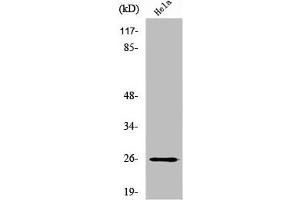 Western Blot analysis of HeLa cells using UMP-CMP Kinase Polyclonal Antibody (Cytidine Monophosphate (UMP-CMP) Kinase 1, Cytosolic (CMPK1) (N-Term) anticorps)