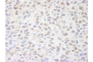 anti-SIN3 homolog A, transcription regulator (SIN3A) (AA 1-50) antibody