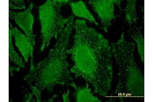 Immunofluorescence of monoclonal antibody to PPP2R5D on HeLa cell.