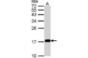 WB Image Sample(30 ug whole cell lysate) A:HeLa S3, 15% SDS PAGE antibody diluted at 1:1000 (CDA anticorps)