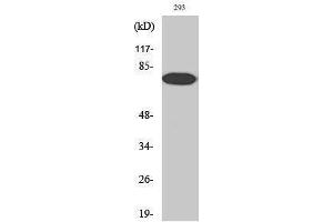 Western Blotting (WB) image for anti-Nuclear Factor-kB p65 (NFkBP65) (pThr254) antibody (ABIN3182091) (NF-kB p65 anticorps  (pThr254))