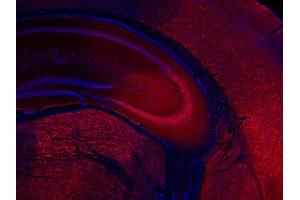 Immunohistochemistry (IHC) image for anti-Ubiquitin Carboxyl-terminal Esterase L1 (Ubiquitin Thiolesterase) (UCHL1) (AA 6-223) antibody (ABIN1742479)