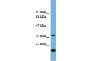 WB Suggested Anti-CTDSP2  Antibody Titration: 0. (CTDSP2 anticorps  (Middle Region))