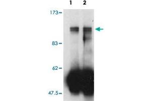 Western blot analysis of immunoprecipitates from mouse cell line lysates using Farp2 polyclonal antibody. (FARP2 anticorps)