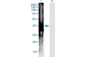 Western Blot analysis of ART4 expression in transfected 293T cell line by ART4 monoclonal antibody (M01), clone 2F8. (ART4 anticorps  (AA 61-160))