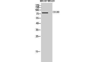 Western Blotting (WB) image for anti-CD180 Molecule (CD180) (Internal Region) antibody (ABIN3181467) (CD180 anticorps  (Internal Region))
