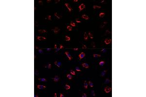 Immunofluorescence analysis of L929 cells using IL11 antibody (ABIN6128128, ABIN6142292, ABIN6142293 and ABIN6219040) at dilution of 1:100. (IL-11 anticorps  (AA 22-199))