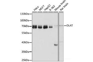 Western blot analysis of extracts of various cell lines using DLAT Polyclonal Antibody at dilution of 1:1000. (DLAT anticorps)