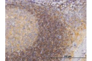 Immunoperoxidase of monoclonal antibody to PIK3R4 on formalin-fixed paraffin-embedded human tonsil.