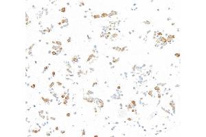 Immunocytochemistry (ICC) image for anti-Nuclear Factor-kB p65 (NFkBP65) (C-Term) antibody (ABIN7795799) (Recombinant NF-kB p65 anticorps  (C-Term))