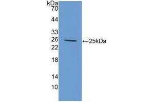 Detection of Recombinant IL6, Canine using Polyclonal Antibody to Interleukin 6 (IL6)