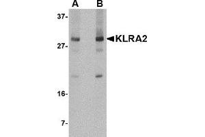 Western Blotting (WB) image for anti-Killer Cell Lectin-Like Receptor, Subfamily A, Member 2 (Klra2) (C-Term) antibody (ABIN1030472) (Klra2 anticorps  (C-Term))