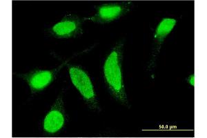 Immunofluorescence of monoclonal antibody to CSNK1D on HeLa cell. (Casein Kinase 1 delta anticorps  (AA 301-415))
