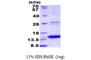 SDS-PAGE (SDS) image for Late Endosomal/lysosomal Adaptor, MAPK and mTOR Activator 2 (LAMTOR2) (AA 1-125) protein (His tag) (ABIN5852943)