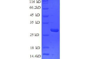 SDS-PAGE (SDS) image for Epiplakin 1 (EPPK1) (AA 1-225), (partial) protein (His tag) (ABIN5709481)