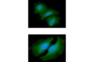 ICC/IF analysis of HTATIP2 in A549 cells line, stained with DAPI (Blue) for nucleus staining and monoclonal anti-human HTATIP2 antibody (1:100) with goat anti-mouse IgG-Alexa fluor 488 conjugate (Green).