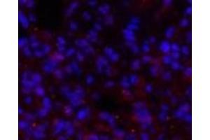 Immunofluorescence analysis of Rat lung tissue using BRCA1 Polyclonal Antibody at dilution of 1:200. (BRCA1 anticorps)