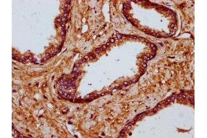 IHC image of ABIN7174945 diluted at 1:700 and staining in paraffin-embedded human prostate tissue performed on a Leica BondTM system.