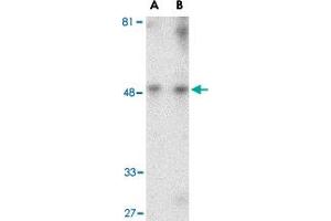 Western blot analysis of HAVCR1 in human uterus tissue lysate with HAVCR1 polyclonal antibody  at (A) 1 and (B) 2 ug/mL . (HAVCR1 anticorps  (Internal Region))