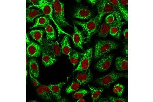Immunofluorescence Analysis of A549 cells labeling CK14 with Cytokeratin 14 Mouse Monoclonal Antibody (LL002) followed by Goat anti-Mouse IgG-CF488 (Green).