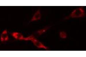 ABIN6274254 staining Hela cells by IF/ICC. (NBL1 anticorps  (C-Term))