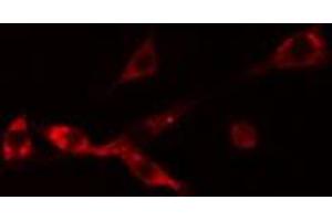 ABIN6274254 staining Hela cells by IF/ICC.