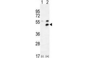 Western blot analysis of MPP1 (arrow) with 293 cell lysates (2 ug/lane) either nontransfected (Lane 1) or transiently transfected (Lane 2) with the MPP1 gene using MPP1