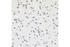 Immunohistochemistry of paraffin-embedded mouse brain using SAFB2 antibody (ABIN5972429) at dilution of 1/100 (40x lens). (SAFB2 anticorps)