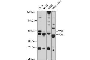 Western blot analysis of extracts of various cell lines, using VDR antibody (ABIN3023180, ABIN3023181, ABIN3023182 and ABIN6219426) at 1:1000 dilution. (Vitamin D Receptor anticorps  (AA 1-300))