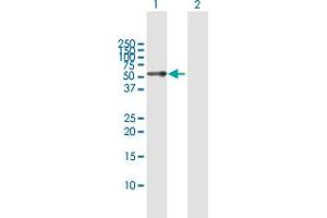 Western Blot analysis of TTC8 expression in transfected 293T cell line by TTC8 MaxPab polyclonal antibody.