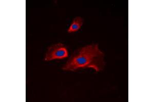 Immunofluorescent analysis of RPS6 (pS235) staining in NIH3T3 cells.