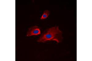 Immunofluorescent analysis of RPS6 (pS235) staining in NIH3T3 cells. (RPS6 anticorps  (C-Term, pSer235))