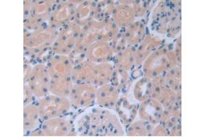 IHC-P analysis of Rat Kidney Tissue, with DAB staining.