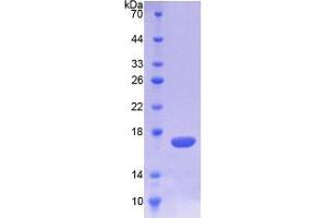 SDS-PAGE analysis of Mouse TREM1 Protein. (TREM1 Protéine)