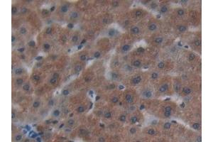 Detection of Cys-C in Human Liver Tissue using Polyclonal Antibody to Cystatin C (Cys-C) (CST3 anticorps  (AA 27-146))