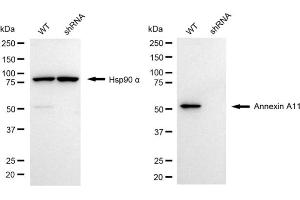 Western blotting analysis using annexin A11 antibody (ABIN7797616). (Annexin A11 anticorps)