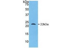 Detection of Recombinant Glucagon, Human using Polyclonal Antibody to Glucagon (GCG)