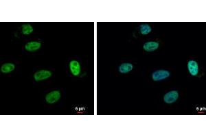 ICC/IF Image SP1 antibody detects SP1 protein at nucleus by immunofluorescent analysis.