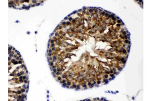 TCP1 theta was detected in paraffin-embedded sections of rat testis tissues using rabbit anti- TCP1 theta Antigen Affinity purified polyclonal antibody (Catalog # ) at 1 µg/mL.